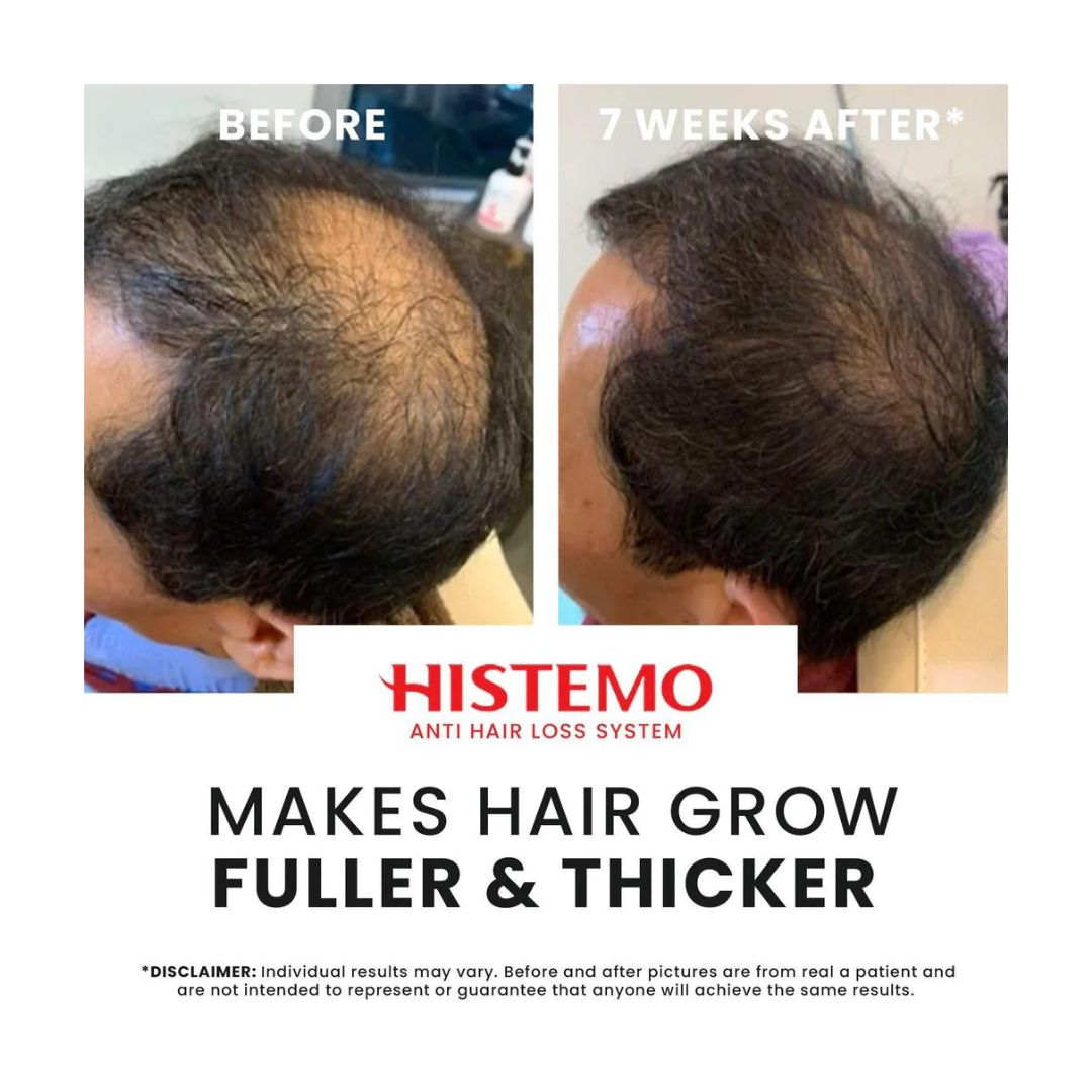 Histemo ION-TO G Hair Tonic