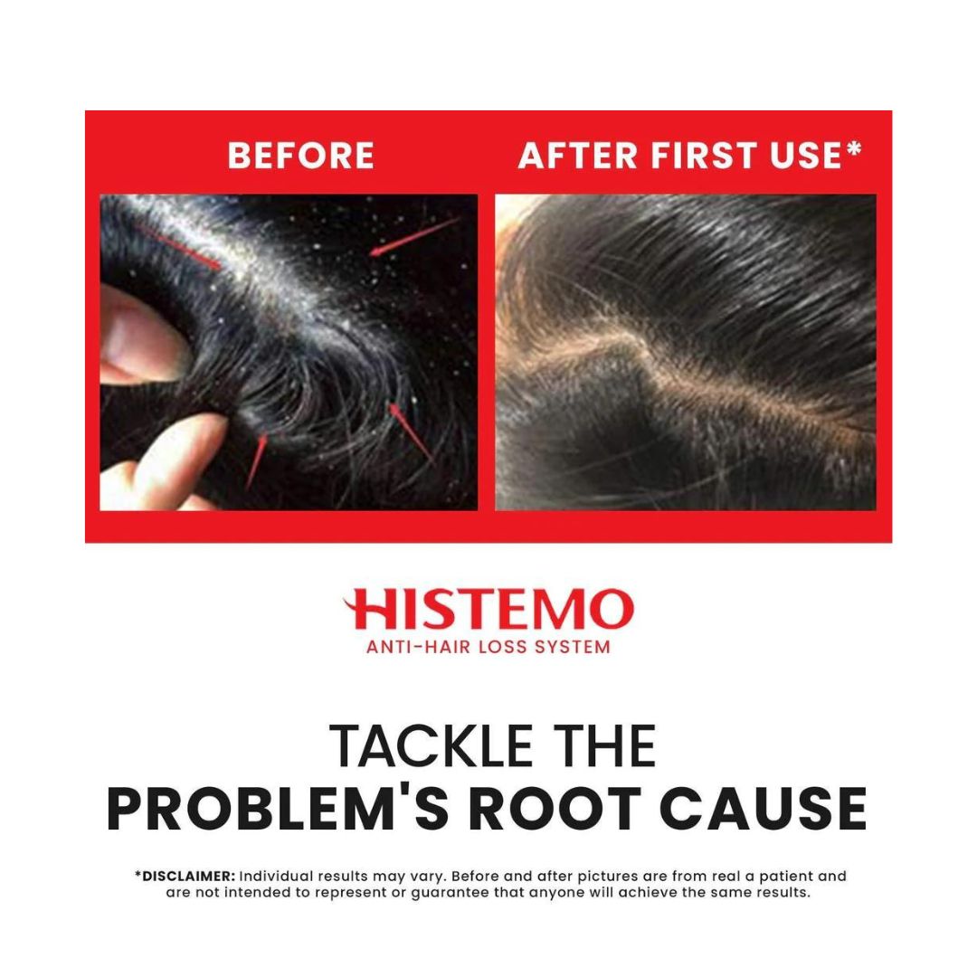 Histemo ION-TO S Scalp Cleanser